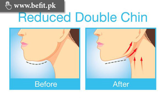 how to reduce double chin